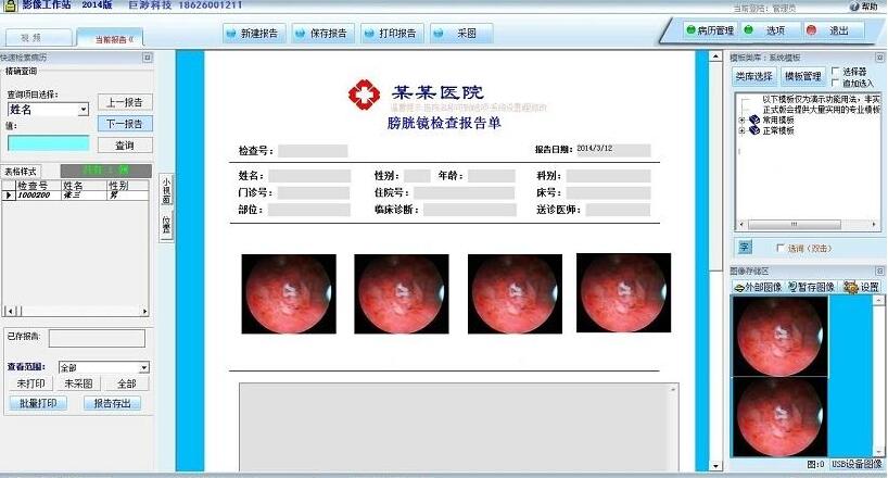 膀胱镜影像系统工作站